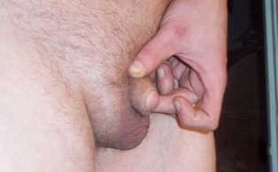 индикации за уголемяване на пениса